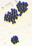 Gram Stain of Candida albicans