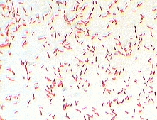 Gram stain of E. coli