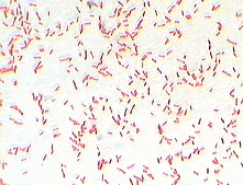 Gram stain of E. coli