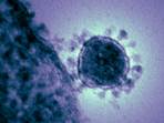 Image result for coronavirus electron micrograph