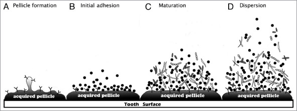 four steps of biofilm/plaque formation on tooth