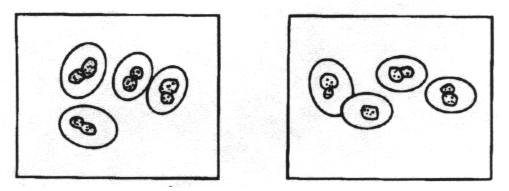 Cryptococcus neoformans