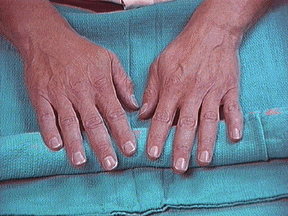 Turn on graphics to view Mr. Potter's hands and nails