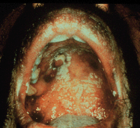 You must activate Browser imaging to see the oral mucosa!