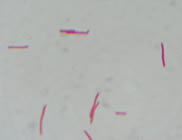 Gram negative rod