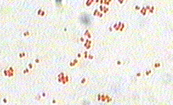 Gram stain of N. sicca