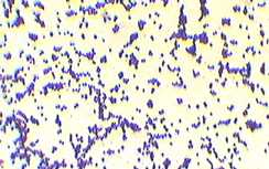 Gram stain of Staphylococcus aureus