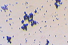 Size comparison of candida to staphylococcus