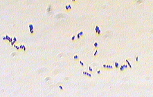 Gram stain of S. pyogenes
