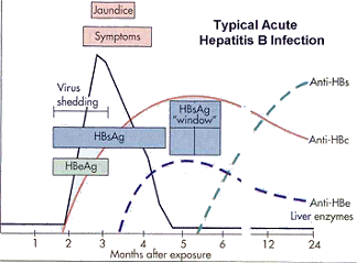 Acute HBV