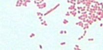 Gram Stain of CSF