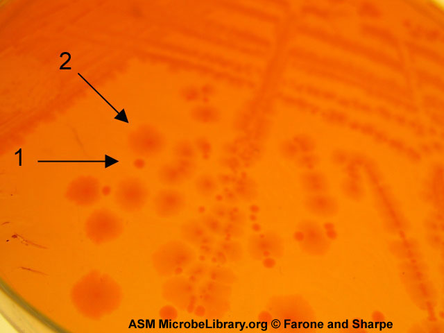 Shigella