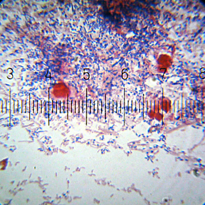 gram stain of dental plaque