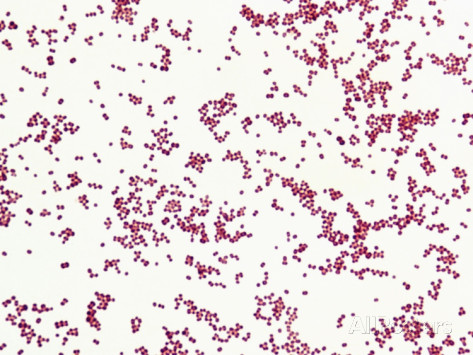 Gram negative cocci