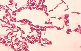 gram negative rods and gram positive cocci