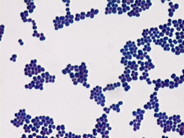 gram negative rods and gram positive cocci