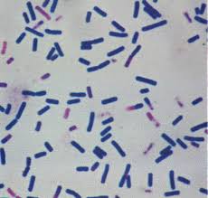 gram negative rods and gram positive cocci