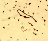 Gram Positive Coccus