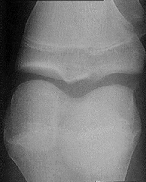 Sally's knee film