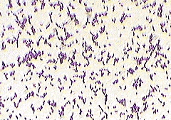 Gram stain of E. faecalis