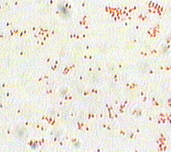Gram stain of H. influenzae