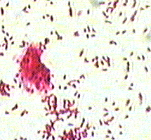 Acid-fast stain of Mycobacterium phlei