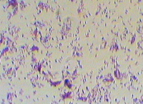 Gram stain of M. phlei