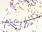 Gram stain of Corynebacterium diptherieae