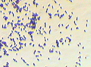 Gram stain of S. pneumoniae