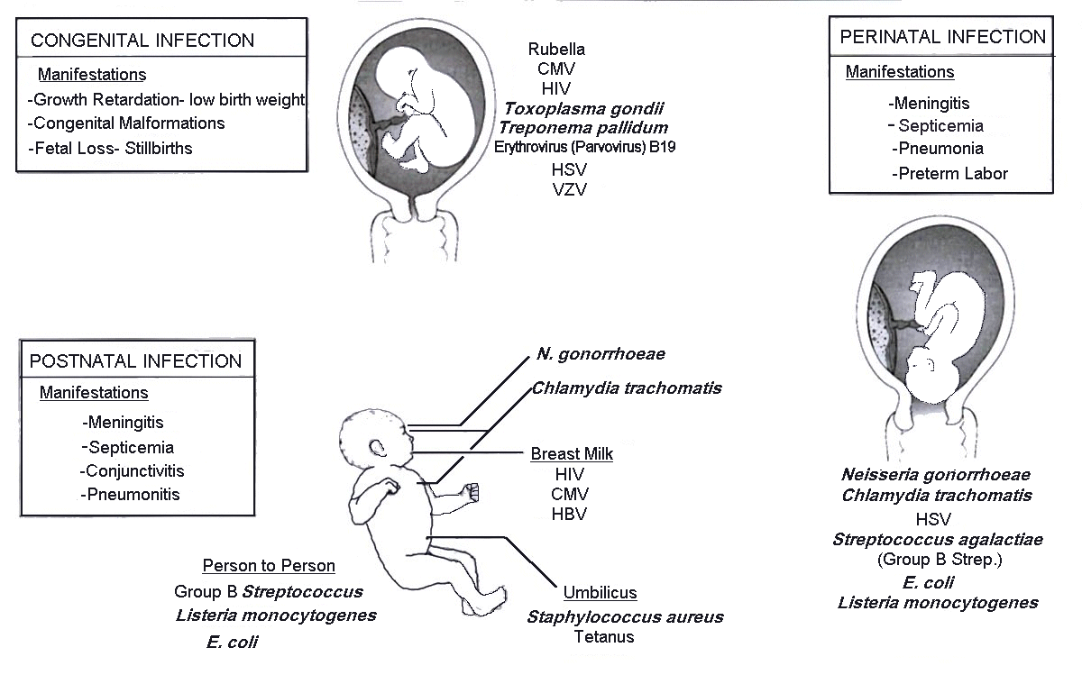 Herpes Simplex Virus in the Newborn - New York State ...