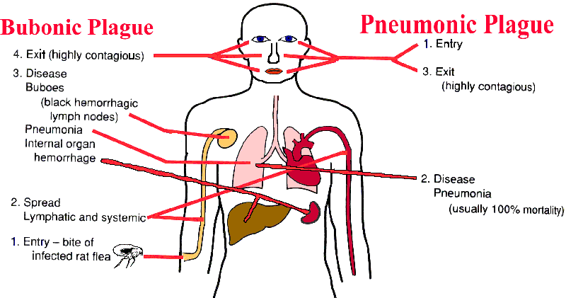 WHAT IS THE PLAGUE SYMPTOMS CAUSES DIAGNOSIS AND MORE Chiid Health