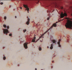 Gram Stain not available without Browser imaging enabled!